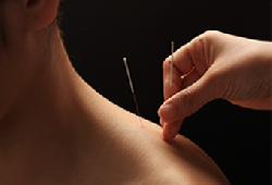Anna Health LLC to Provide Free Acupuncture Treatments this Thanksgiving 2015